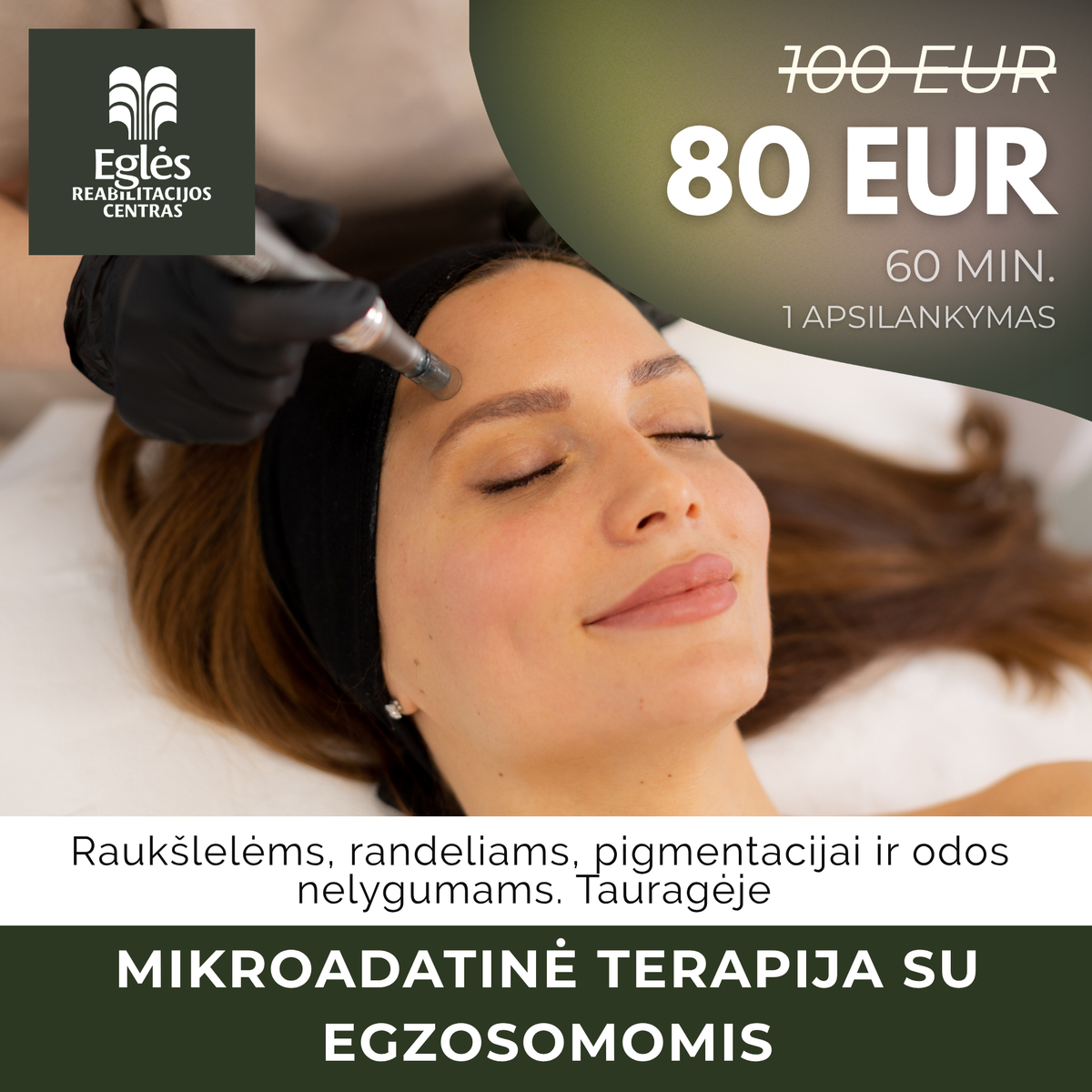 Mikroadatinė terapija su egzosomomis TAURAGĖJE 60 MIN.