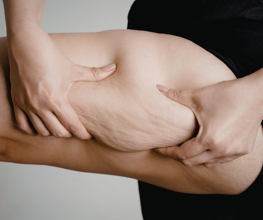 „Kaip sumažinti apimtis be dietų?“ „Kaip pagerinti odą be sporto?“